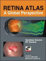 Retina Atlas: A Global Perspective