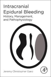 Intracranial Epidural Bleeding - History, Management, and Pathophysiology