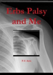 Erbs Palsy and Me