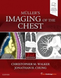 Muller's Imaging of the Chest - Expert Radiology Series