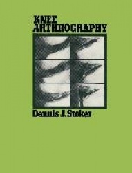 Knee Arthrography