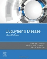 Dupuytren's Disease : A Scientific Review
