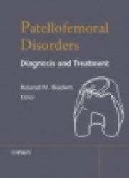 Patellofemoral Disorders - Diagnosis and Treatment