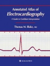 Annotated Atlas of Electrocardiography : A Guide to Confident Interpretation