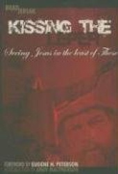 Kissing the Leper: Seeing Jesus in the Least of These