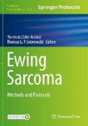 Ewing Sarcoma - Methods and Protocols