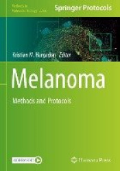 Melanoma - Methods and Protocols