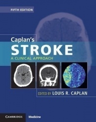 Caplan's Stroke - A Clinical Approach