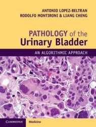 Pathology of the Urinary Bladder: An Algorithmic Approach