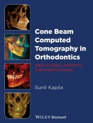 Cone Beam Computed Tomography in Orthodontics - Indications, Insights, and Innovations