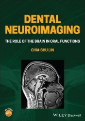 Dental Neuroimaging - The Role of the Brain in Oral Functions