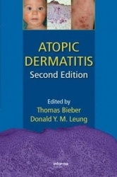 Atopic Dermatitis