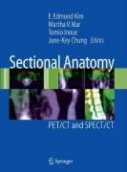 Sectional Anatomy - PET/CT and SPECT/CT
