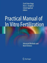 Practical Manual of In Vitro Fertilization - Advanced Methods and Novel Devices
