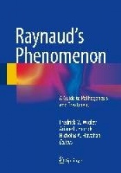 Raynaud’s Phenomenon : A Guide to Pathogenesis and Treatment