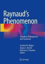Raynaud’s Phenomenon : A Guide to Pathogenesis and Treatment