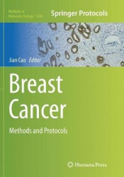 Breast Cancer - Methods and Protocols