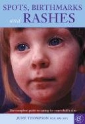 Spots, Birthmarks and Rashes: The Complete Guide to Caring for Your Child's Skin
