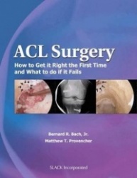 ACL Surgery - How to Get it Right the First Time and What to Do When Your Surgery Fails