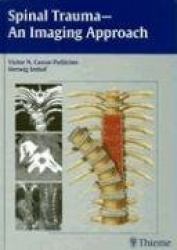 Spinal Trauma - An Imaging Approach
