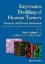 Expression Profiling of Human Tumors : Diagnostic and Research Applications