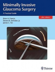 Minimally Invasive Glaucoma Surgery - A Practical Guide