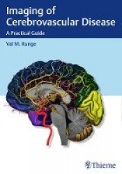 Imaging of Cerebrovascular Disease - A Practical Guide
