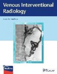Venous Interventional Radiology