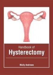 Handbook of Hysterectomy