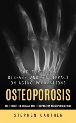 Osteoporosis - Quick and Effective Remedy for Stronger Bones (The Forgotten Disease and Its Impact on Aging Populations)