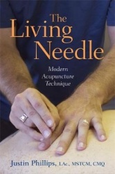 The living needle - modern acupuncture technique
