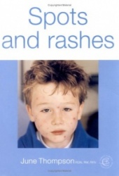 Spots and Rashes