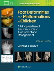 Foot Deformities and Malformations in Children - A Principles-Based, Practical Guide to Assessment and Management: Print + eBook