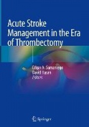 Acute Stroke Management in the Era of Thrombectomy