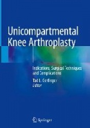 Unicompartmental Knee Arthroplasty : Indications, Surgical Techniques and Complications