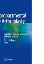 Unicompartmental Knee Arthroplasty : Indications, Surgical Techniques and Complications