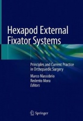 Hexapod External Fixator Systems : Principles and Current Practice in Orthopaedic Surgery