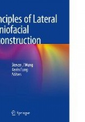 Principles of Lateral Craniofacial Reconstruction
