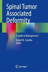 Spinal Tumor Associated Deformity : A Guide to Management