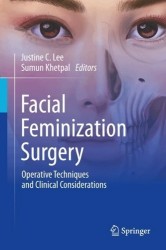 Facial Feminization Surgery