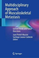 Multidisciplinary Approach of Musculoskeletal Metastasis - Current Trends and Future Directions