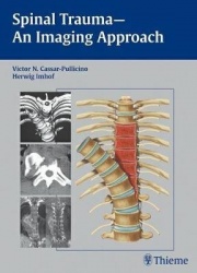 Spinal Trauma - An Imaging Approach