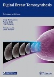Digital Breast Tomosynthesis - Technique and Cases