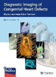 Diagnostic Imaging of Congenital Heart Defects - Diagnosis and Image-Guided Treatment