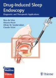 Drug-Induced Sleep Endoscopy - Diagnostic and Therapeutic Applications