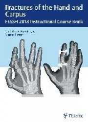 Fractures of the Hand and Carpus - FESSH 2018 Instructional Course Book