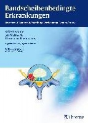 Bandscheibenbedingte Erkrankungen