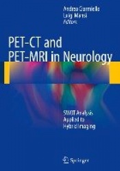 PET-CT and PET-MRI in Neurology : SWOT Analysis Applied to Hybrid Imaging