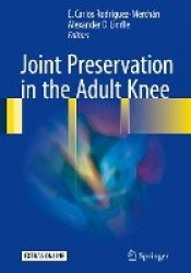 Joint Preservation in the Adult Knee