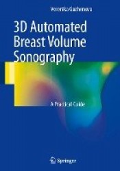 3D Automated Breast Volume Sonography : A Practical Guide